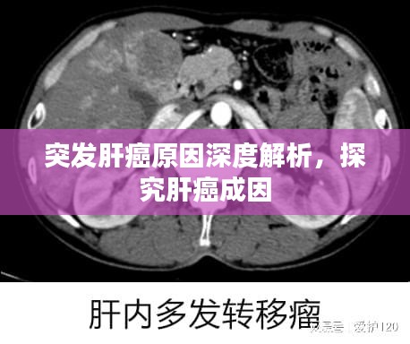 突發肝癌原因深度解析，探究肝癌成因