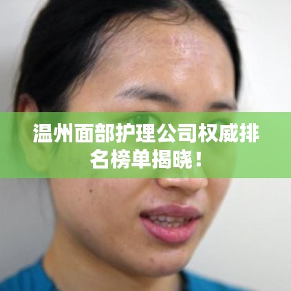 溫州面部護理公司權威排名榜單揭曉！