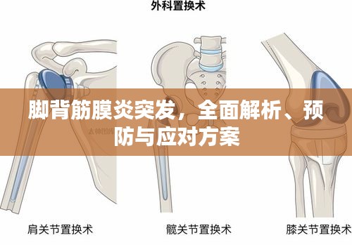 腳背筋膜炎突發，全面解析、預防與應對方案