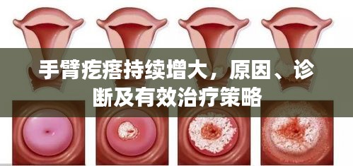 手臂疙瘩持續增大，原因、診斷及有效治療策略