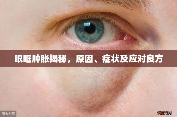 眼眶腫脹揭秘，原因、癥狀及應(yīng)對良方