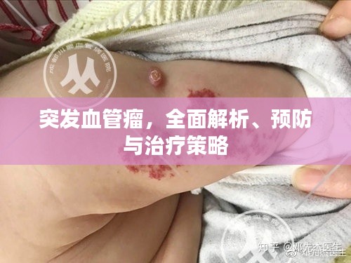 突發血管瘤，全面解析、預防與治療策略